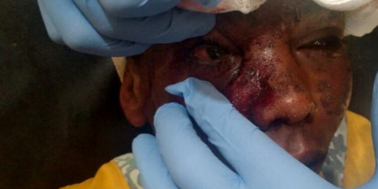 صور مأساوية.. إصابة طفلين بانفجار مخلفات التحالف في مأرب والحديدة